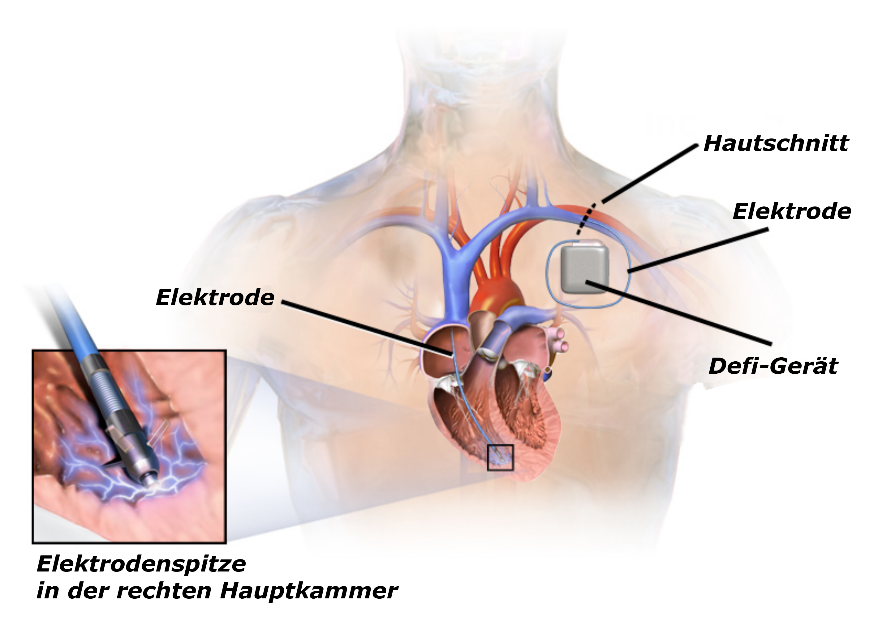 Elektrik des Herzens