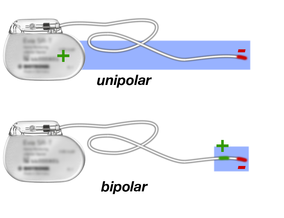 Elektrik