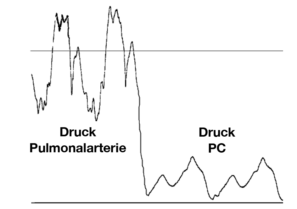 Druckkurve