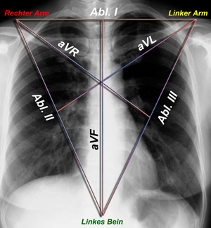 Ableitungssystem